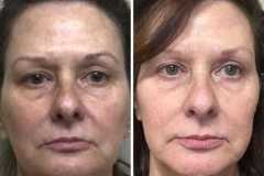 1718754636-photofacial-10